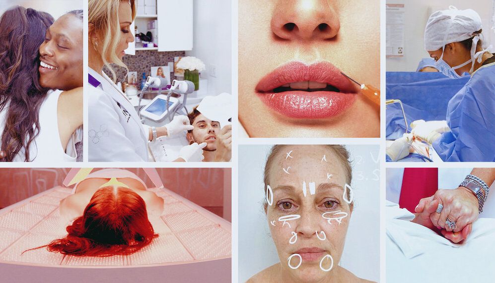 Operação auto-estima antes e depois e a desconstrucao da competição feminina